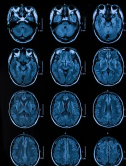 Neuroimaging services providing brain and nervous system scans.