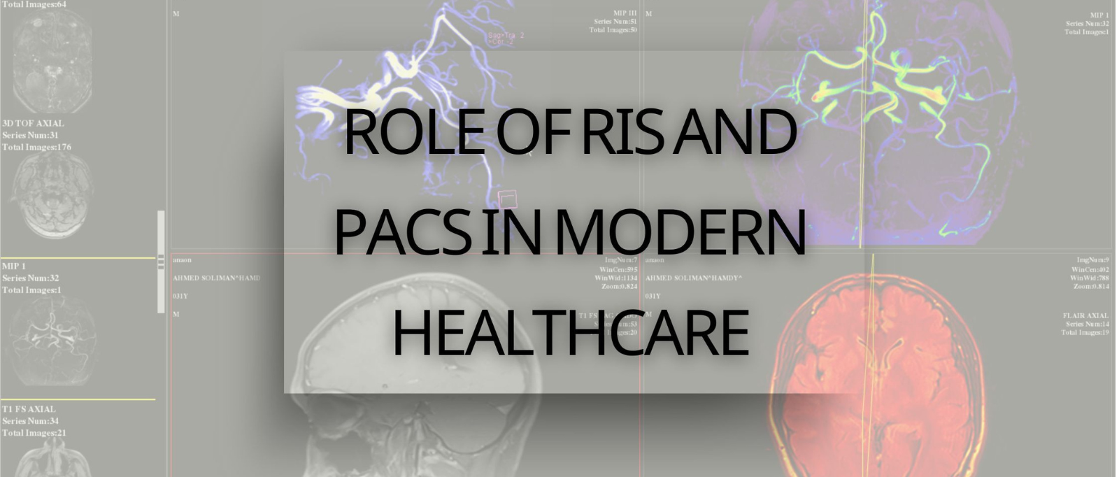 Blog banner highlighting radiology services and technology