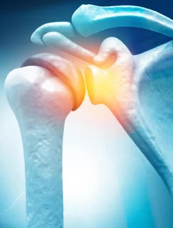 Musculoskeletal radiology services specializing in bone, joint, and muscle imaging.